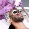 Exploring the Various Types of Lasers in Aesthetic Treatments