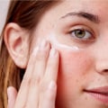 Effective Strategies for Managing Redness and Peeling Skin