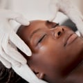 Professional Treatments for Stubborn Acne: Finding Solutions at Medical Spas