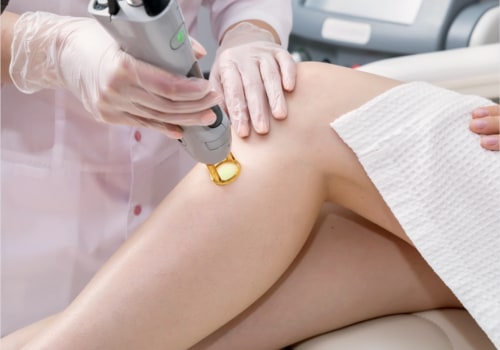 Understanding the Consultation Process for Laser Hair Removal