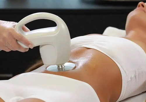 Transforming Your Silhouette: The Benefits of Radiofrequency Body Contouring