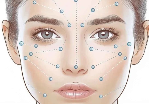 Exploring the Popular Areas for Botox Application
