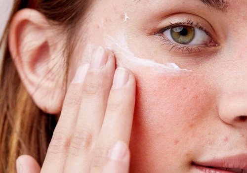 Effective Strategies for Managing Redness and Peeling Skin