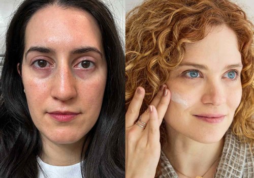 Effective Techniques for Reducing Fine Lines and Wrinkles