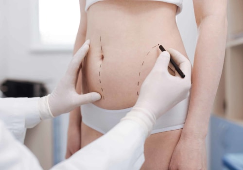 Understanding Ultrasound-Assisted Liposuction for Body Contouring