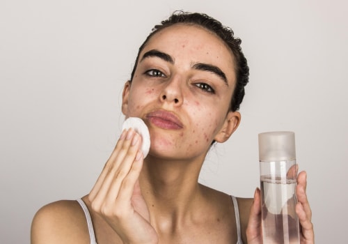 Effective Skincare Routines for Acne-Prone Skin
