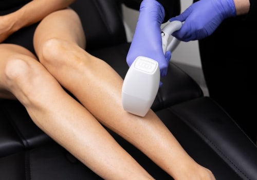 Exploring Laser Hair Removal: Safety and Efficacy